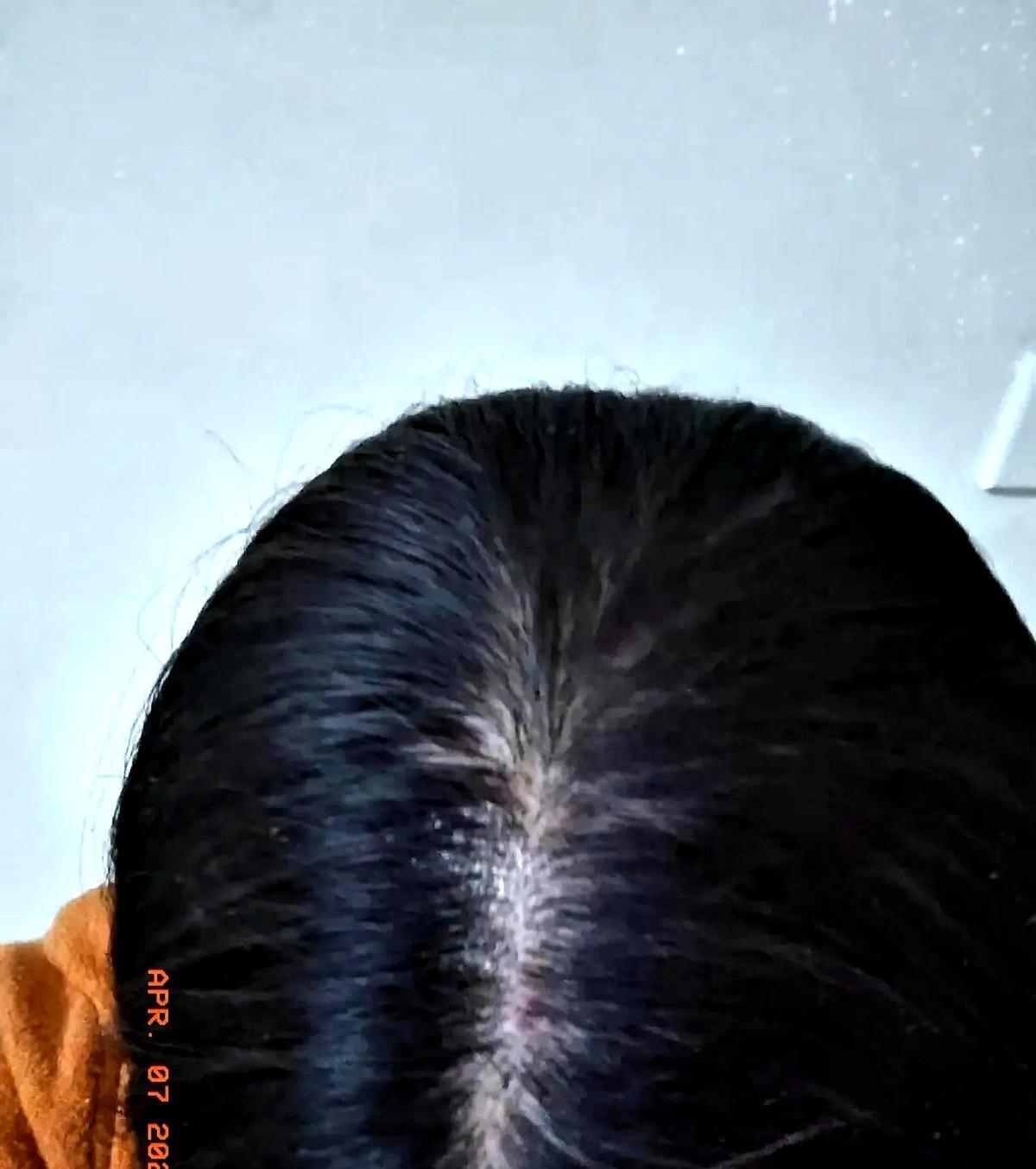 家人们，频繁染发不仅费钱，还可能损害健康。
最近发现身边不少人为了赶时髦，三天两