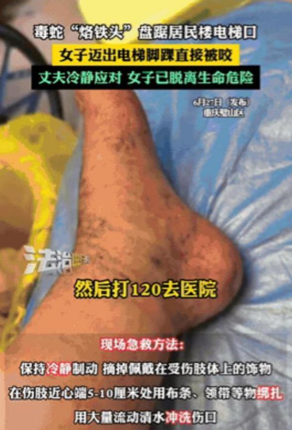 悲剧还是发生了！”重庆，一女子在小区电梯口遭遇毒蛇袭击，脚部迅速肿胀！



6
