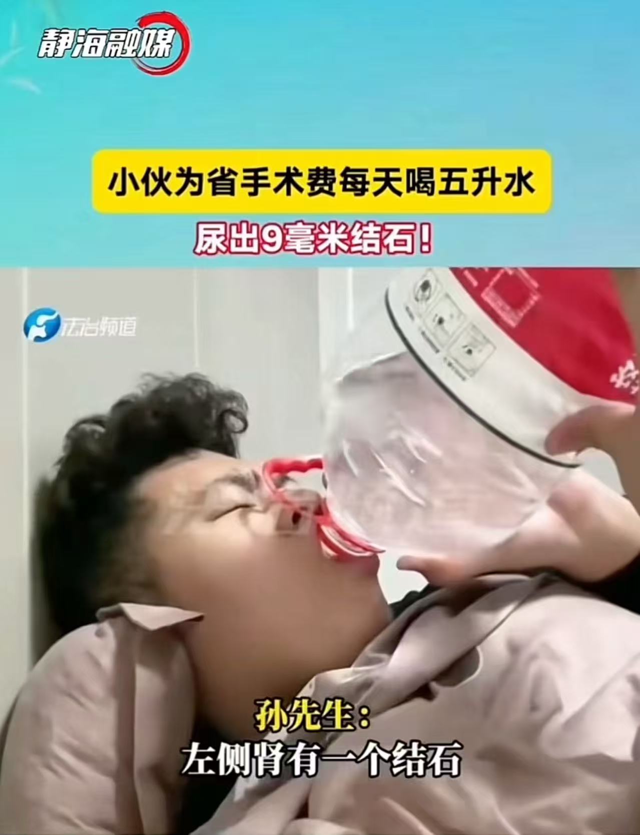 真是一个狠人啊！小伙为了省12000手术费，每天喝五升水，结果尿出9毫米结石！小