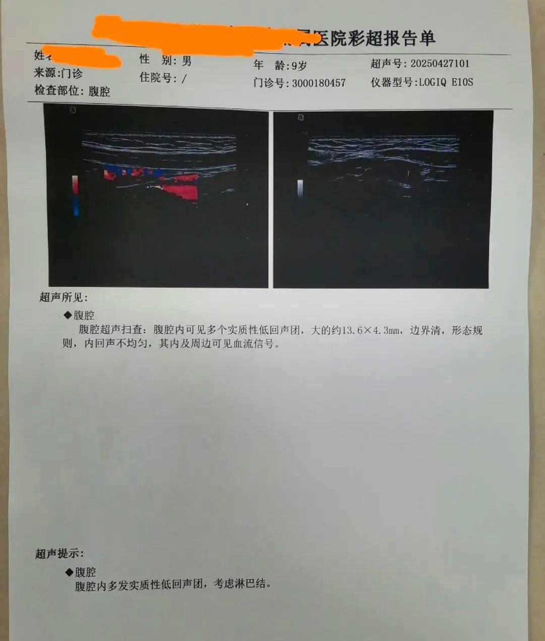 孩子肚子疼
孩子时不时肚子疼，终于找到原因了
前段时间孩子早上起来总是肚子疼，经