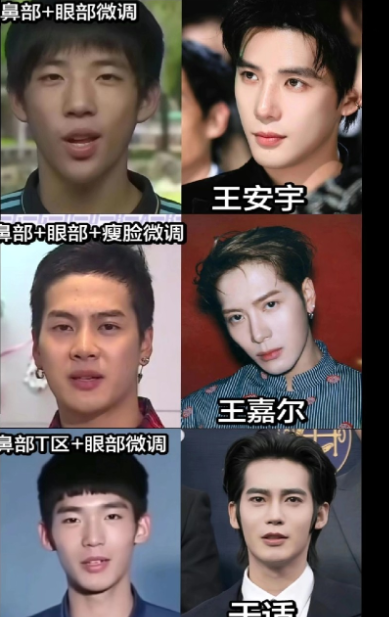 内娱顶流年轻时候照片，说微调，微调也正常，张开了我觉得可能性更大，不管调没调，现