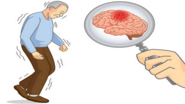 同样是头晕，哪种需要特别警惕心脑血管问题？