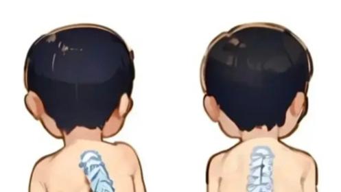 别再做这伤害宝宝脊柱的七大行为了！守护小脊柱，成长不“跑偏”