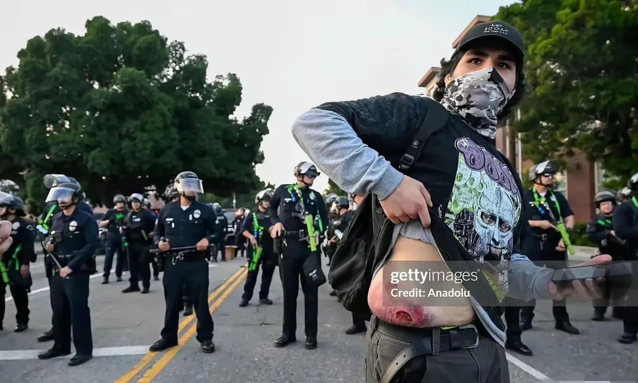 美国洛杉矶抗议者行为已经是遭到了警方屯严厉处置。这时候一些抗议者非常地愤怒，抱怨