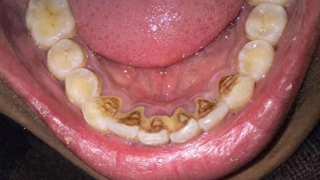 牙膏怎么选？央视推荐十大牙膏排名，第一名白牙、去牙石两手抓！