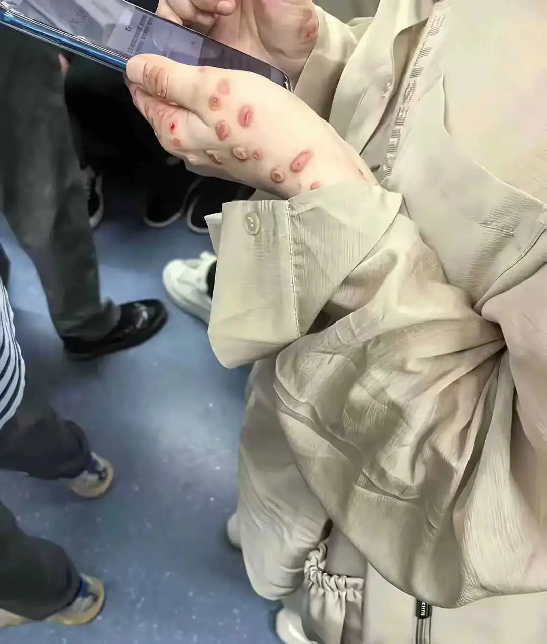 这是啥情况，感觉有点瘆人，会不会传染？