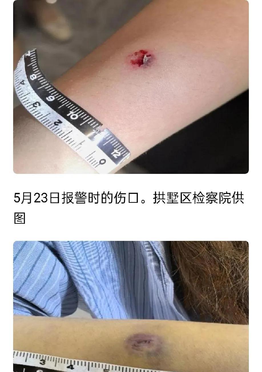 司机无聊弹弓射人，刑责跑不掉，还抹黑弹弓圈，弹弓十戒不能忘。
极目新闻7月28日