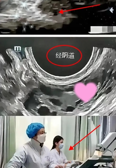 苏州医院“阴超”事件，震碎三观！

5月30日，王女士去苏州市立医院东区做腹部B