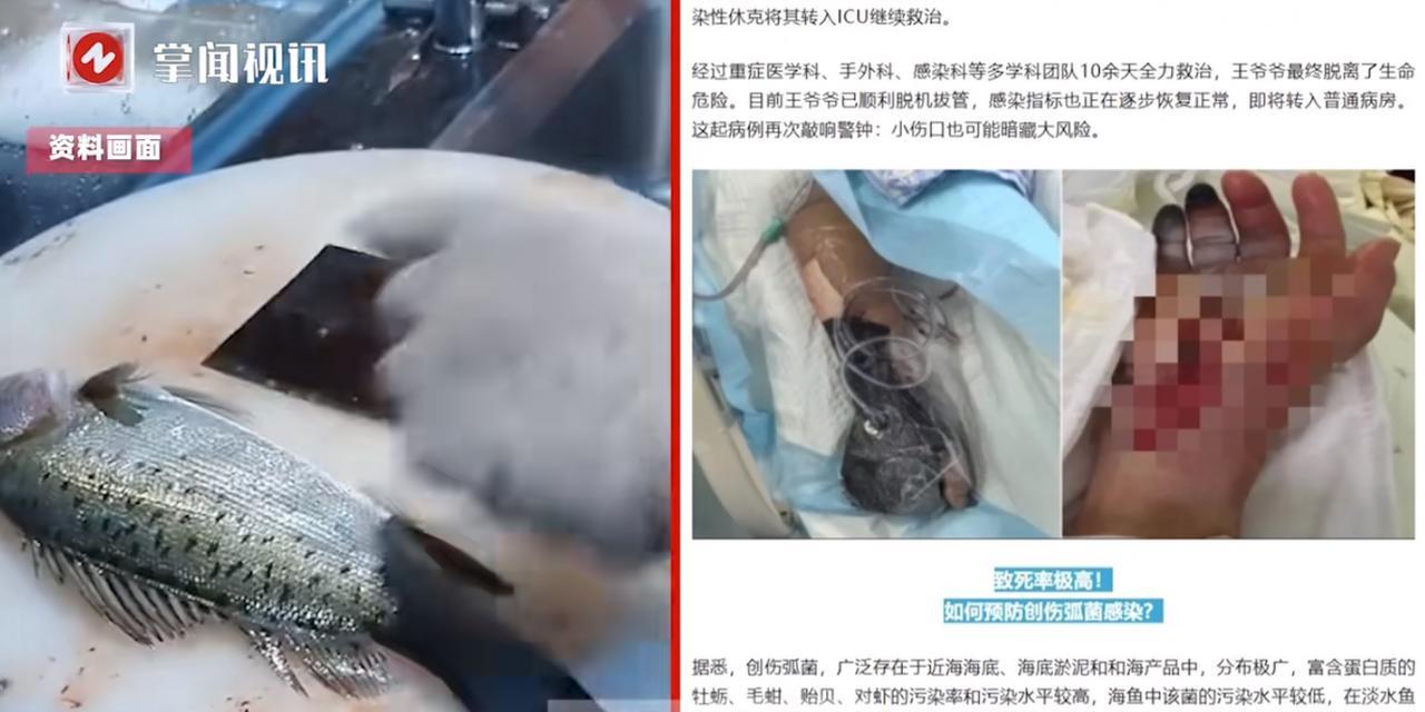 “这下后悔了吧！”近日，浙江绍兴，一位88岁的大爷在家里清洗海鲈鱼时，右手手指不