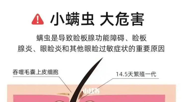 除螨仪有用吗？家用除螨仪有必要买吗？十大公认最好的除螨仪，小白精选款！