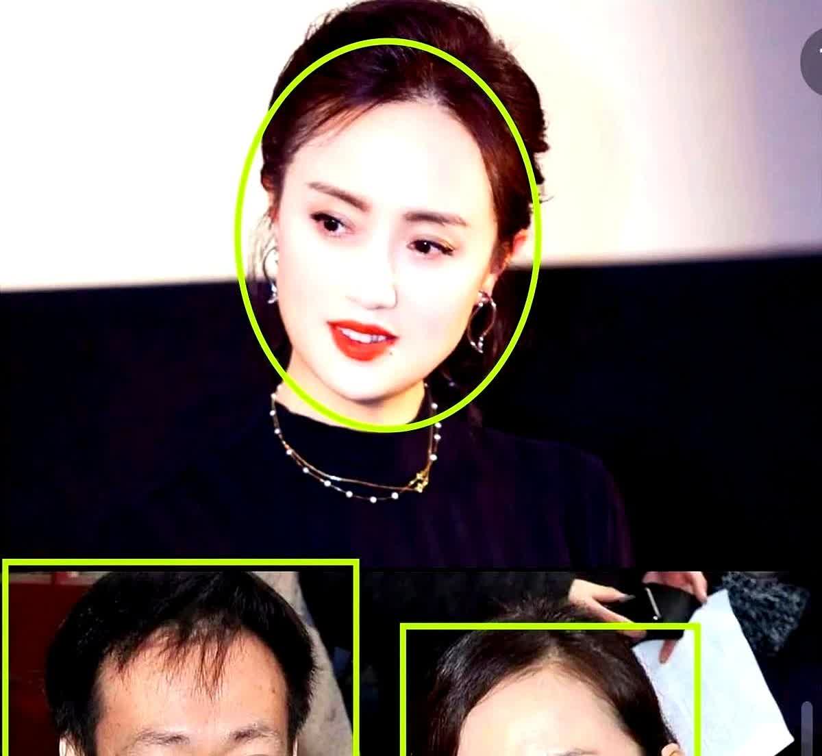 终于知道朱媛媛为什么得癌症了？

不是她饮食习惯不好，也不是她经常熬夜，更不