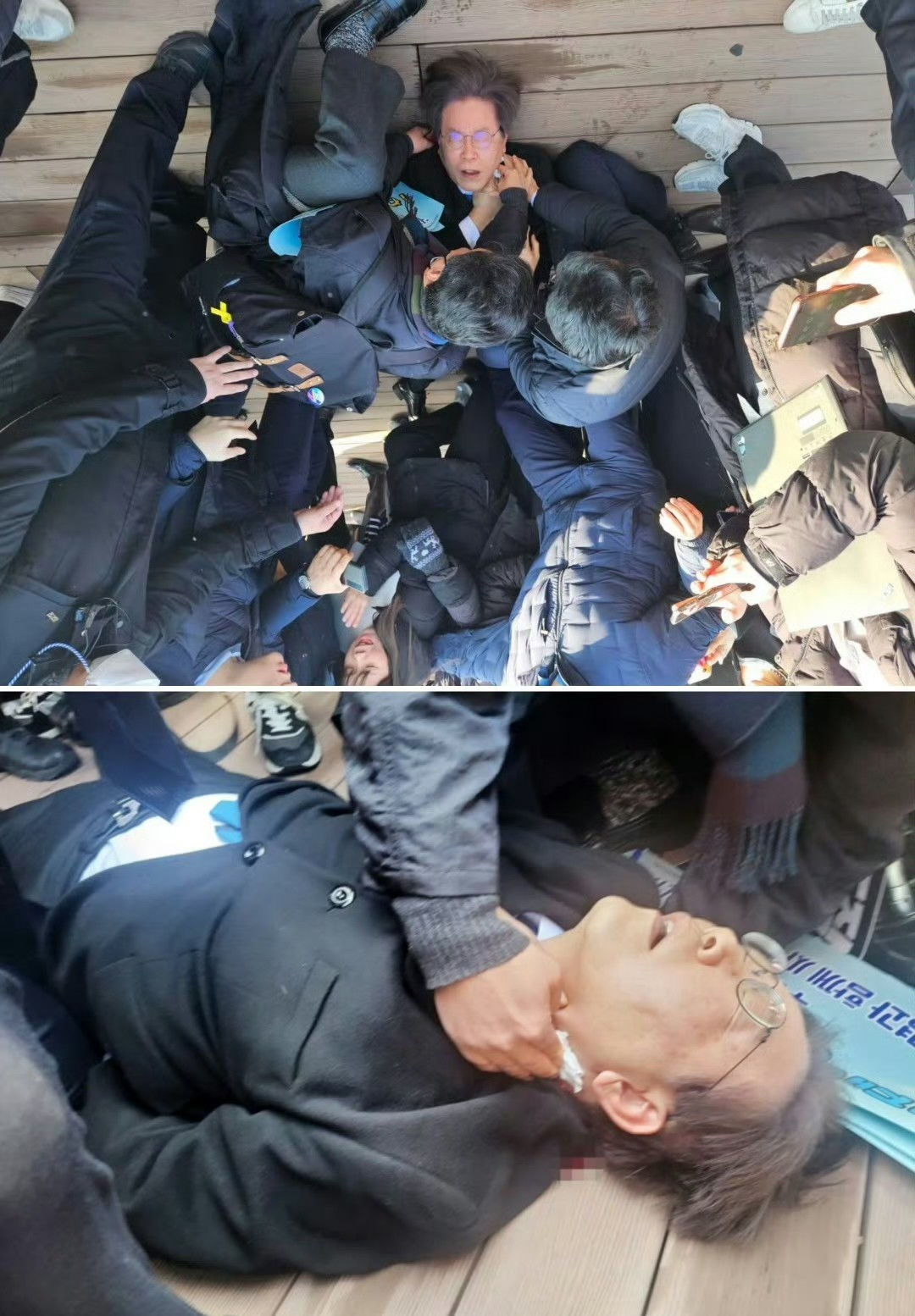 大难不死必有后福啊
韩国第一轻断食，第一跑男[吐舌]

躺在地上正在流血的男人，