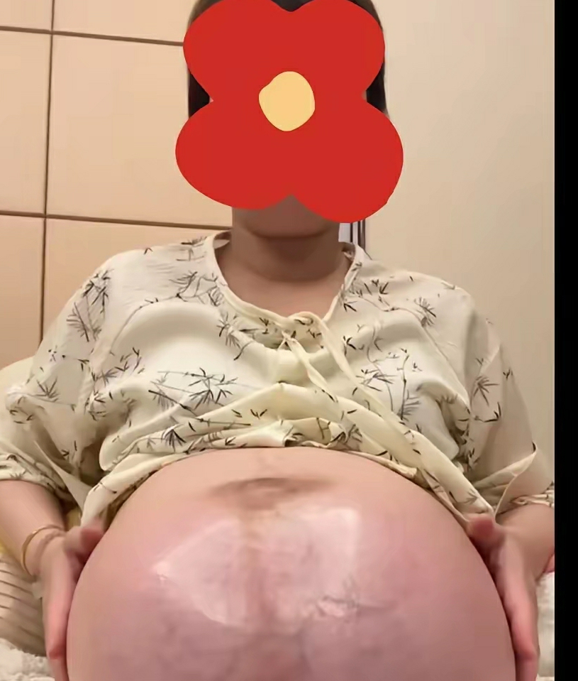 只有生过孩子的女人，看到这种肚子才会感觉到女主有多不容易吧！