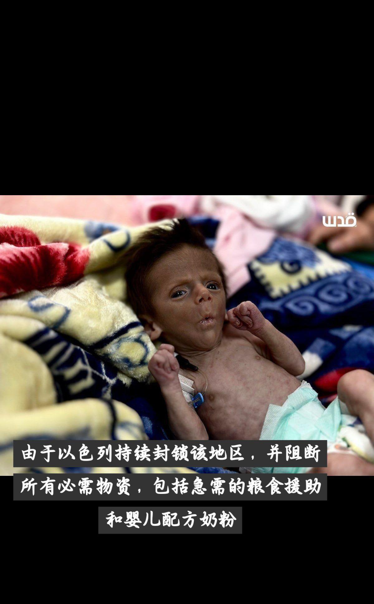 图：由于以色列持续封锁该地区，并阻断所有必需物资，包括急需的粮食援助和婴儿配方奶