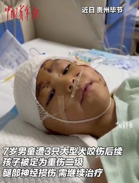 “中国青年报发声了！”2024年3月，7岁男孩被3只恶犬咬致重伤二级，治疗花20
