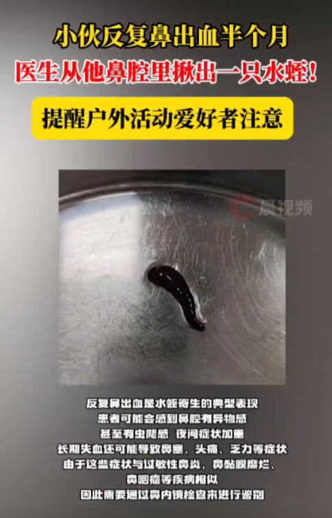 这下后悔了吧！近日，湖南长沙，一男子反复流鼻血，起初他以为是上火，并没有放在心上