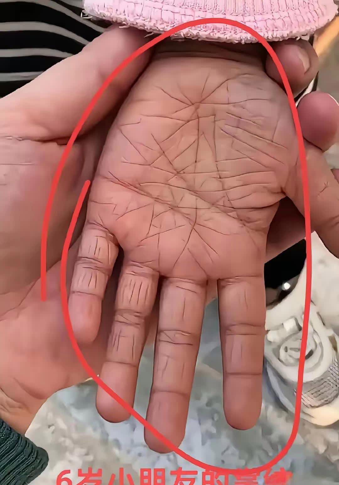 六岁孩子的手，就能看出他未来是“搬砖”还是“弹钢琴”？最近网上一个关于孩子掌纹粗