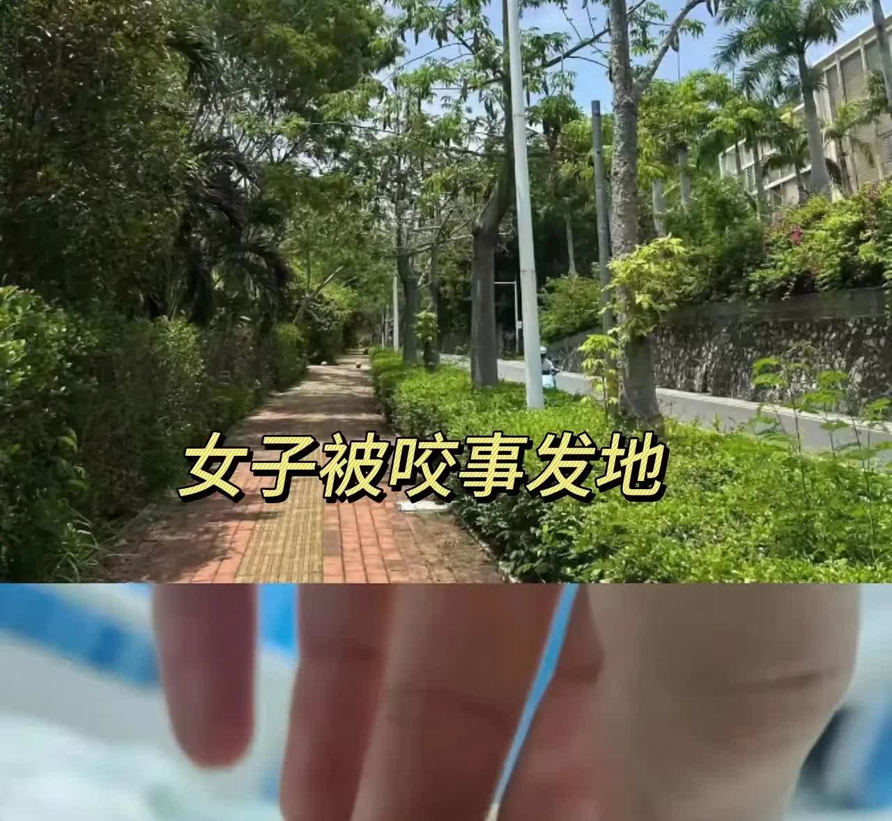三亚被咬女子又被扒了这几个重要细节:
1.该女子，是走在绿化带上面被咬的，旁边