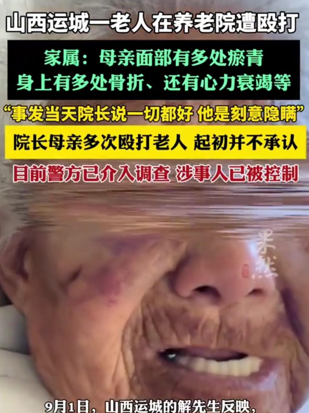 实在是太令人发指了。
竟然殴打一个老年痴呆的人。
近日，山西运城一老人在养老院遭