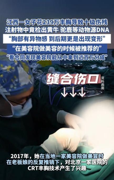 “这是真的有钱任性！”2017年，江西宜春一位女子在做美容时，听信了老板娘的推荐