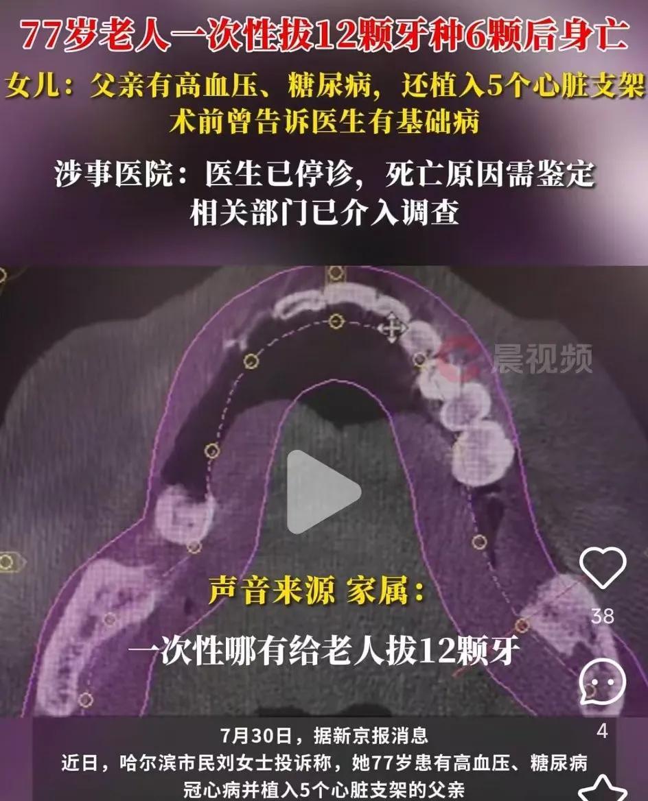 无语，即便没有基础病也没听说哪家牙医会一次性给老人拔12颗牙啊！
医生在拔牙前知