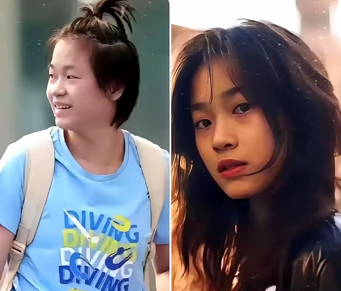 刚过完18岁生日的全红婵，脚踝抽出来的积液装了28ml瓶子，黄得晃眼。脊椎两处劳