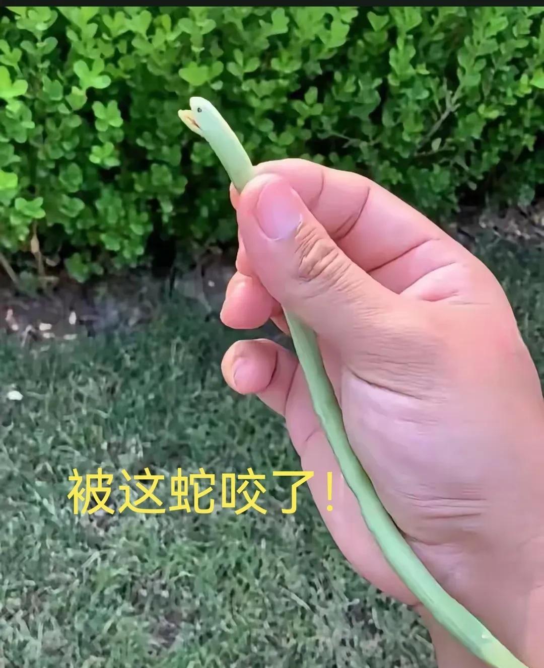 被这蛇咬了，请问挂什么科好呢？[捂脸][捂脸][捂脸]