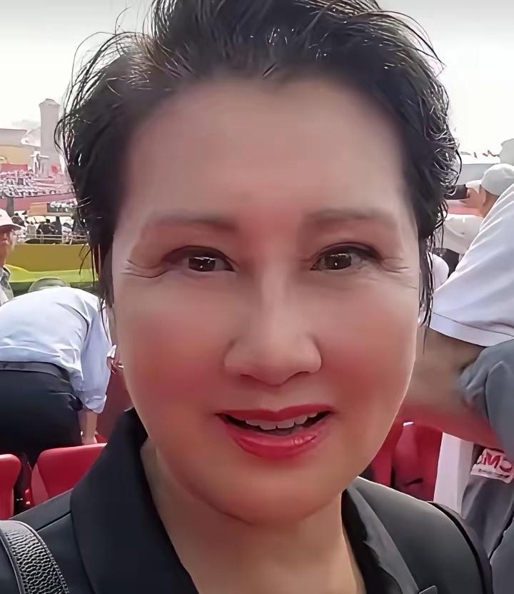 张凯丽的眼睛有点奇怪
按道理双眼皮会让眼睛变大
可实际上，她的眼睛不仅没变大，反