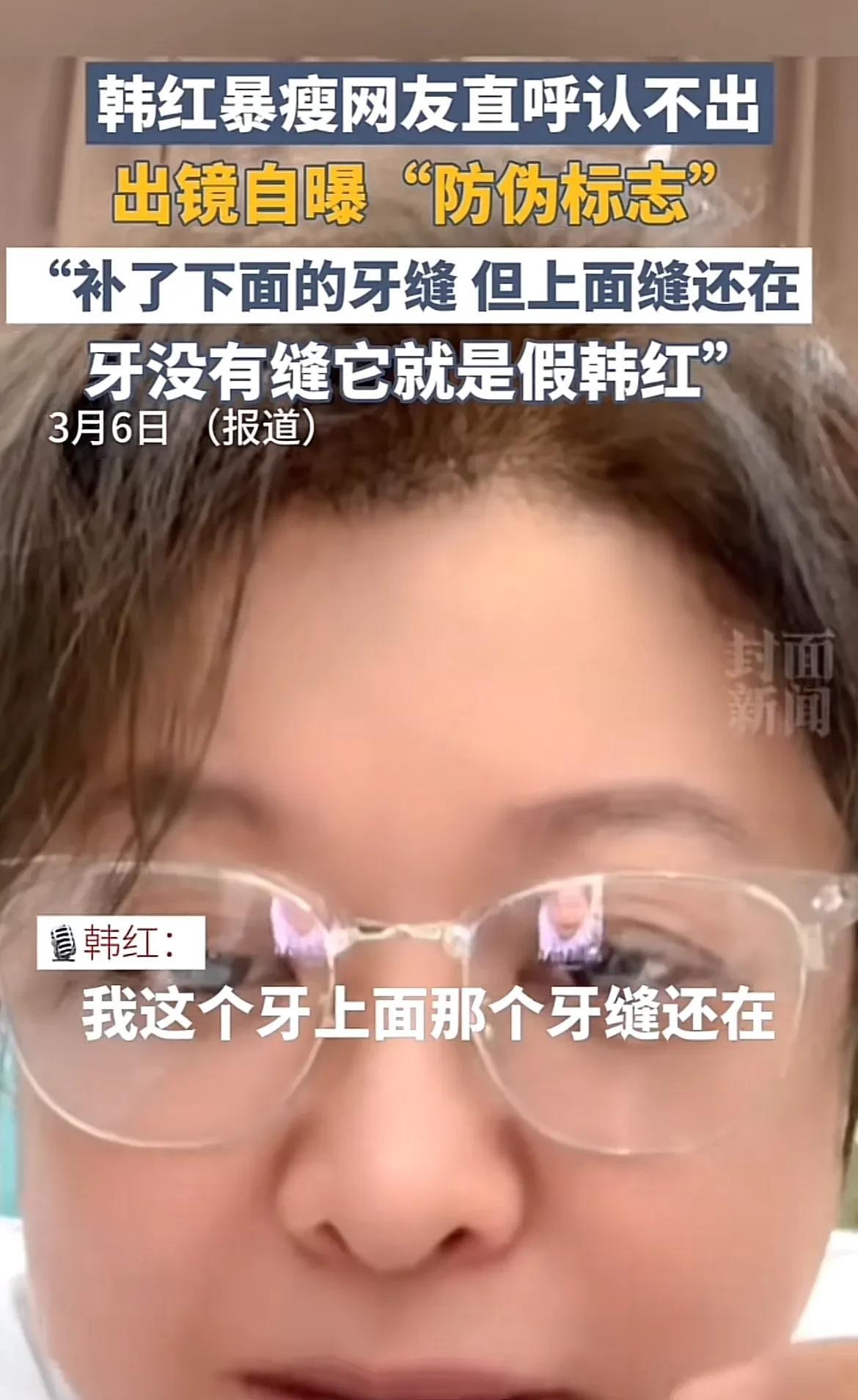看到韩红暴瘦了，网友直呼认不出来了！
说牙齿没有缝儿的就是假韩红，韩红说她把下面