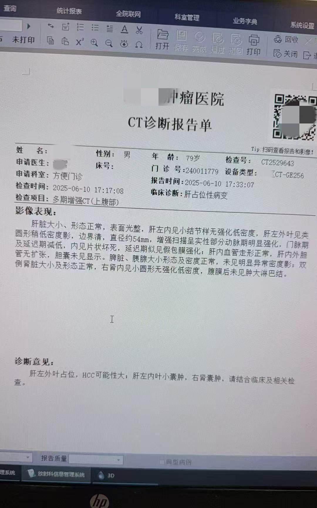 80岁老人被检查出肝部有占位性病变（直径大概54mm）。医生提议进行手术。
全家