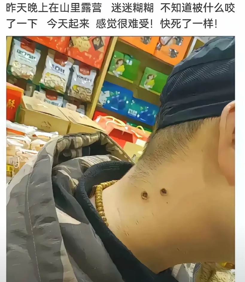 应该没事吧，蹲一个后续