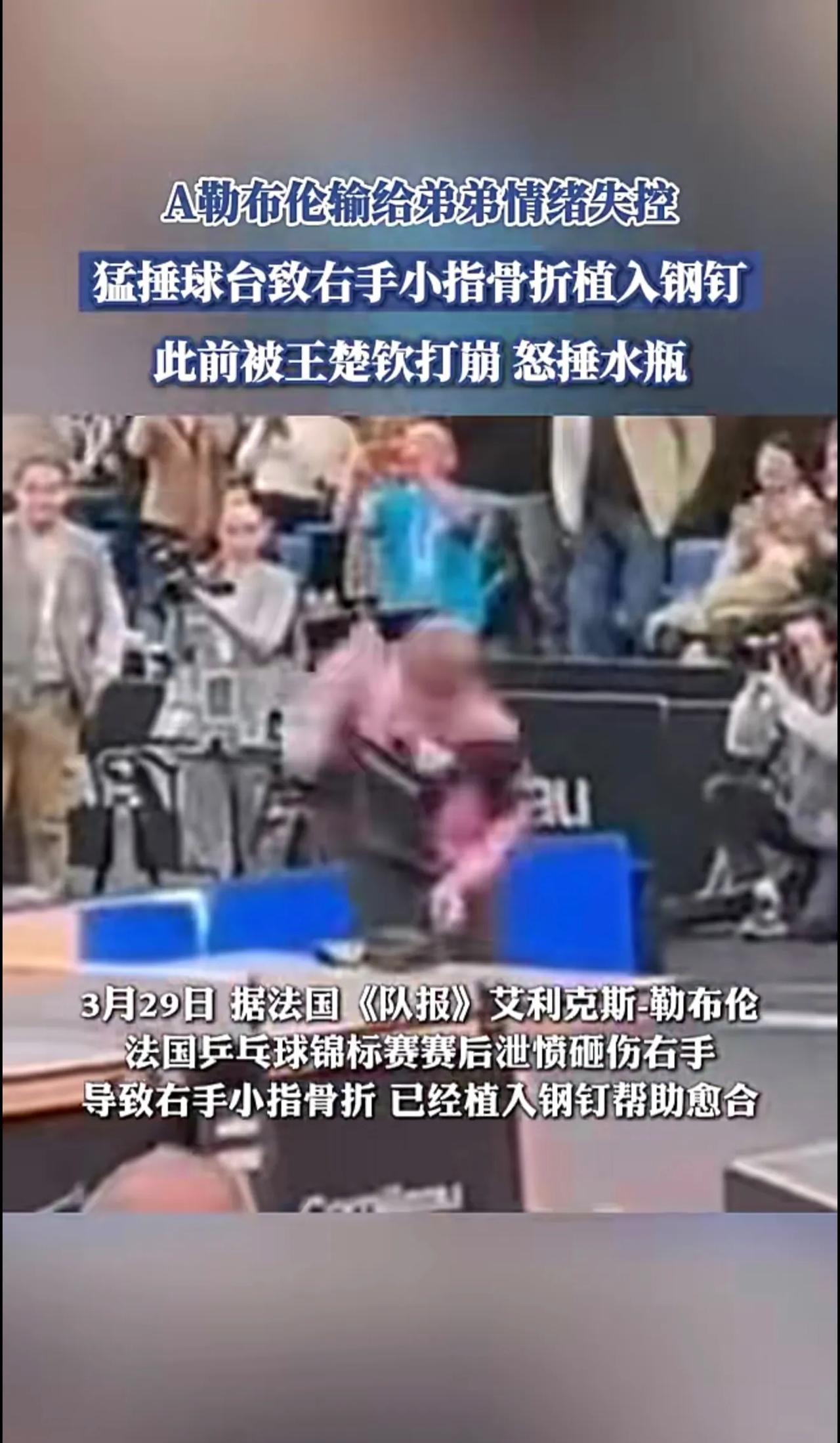 A勒布伦输给弟弟情绪失控，猛捶球台致右手小指骨折植入钢钉[捂脸]