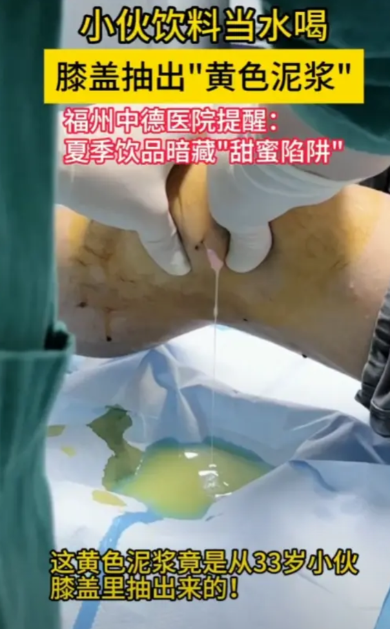 “太吓人了！”福州33岁男子从不喝水，渴了就喝饮料。坚持了半年，男子突然感觉脚痛