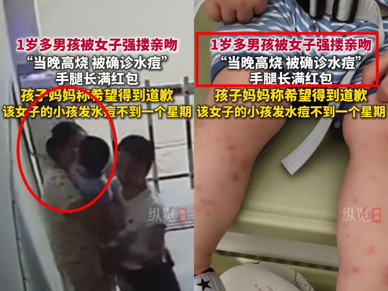 “缺德到这份上也是绝了！”
湖南这女子，为了自己孩子能早康复，
竟故意把水痘