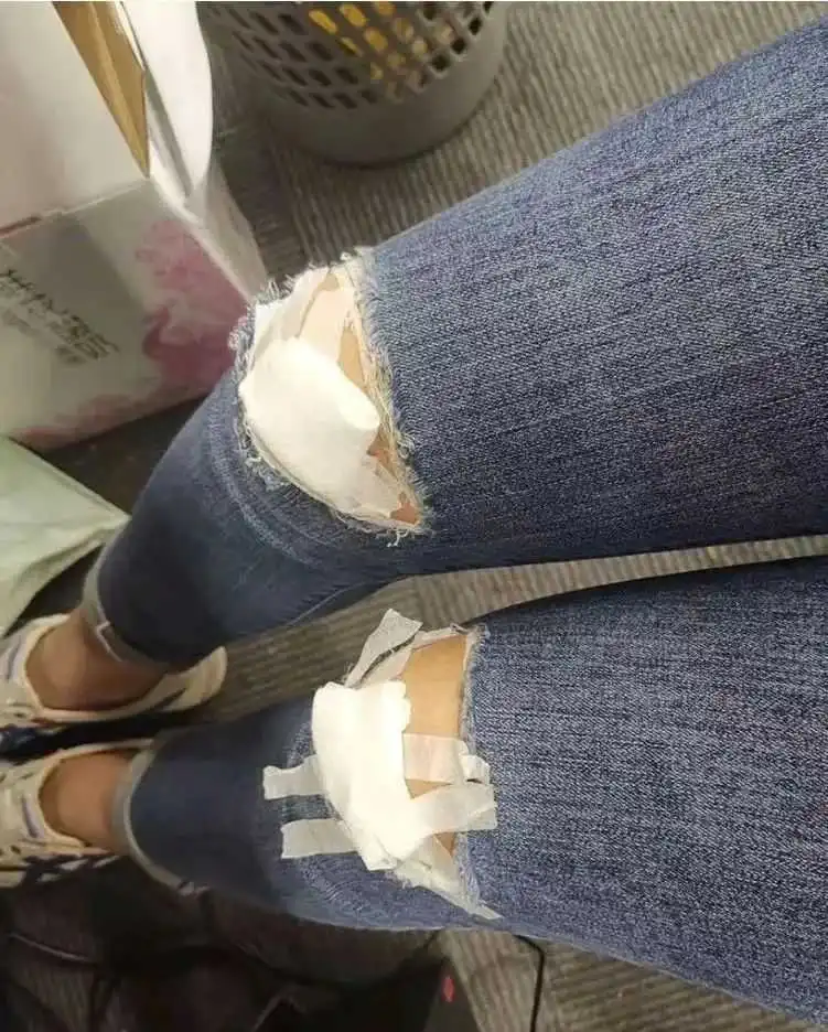 穿破洞裤在公司门口摔了一跤，呜呜呜，太疼了！