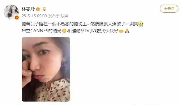 说自己抱着儿子睡在了一个外面的枕头上，导致自己的脸过敏了，最后在文末加上了哭哭~