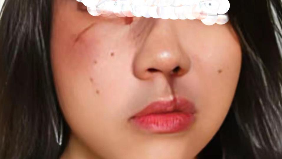 九寨沟酒店冲突：冲动酿纠纷