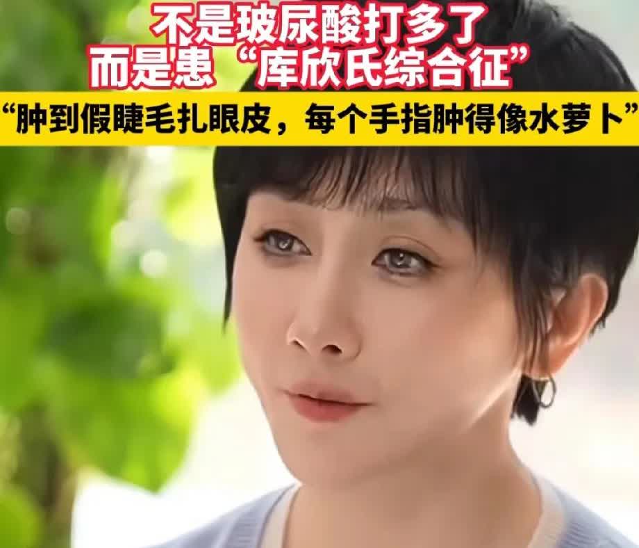 为什么很多女明星明明自己整过容，却打死也不承认。

最近44岁的某不知名女明