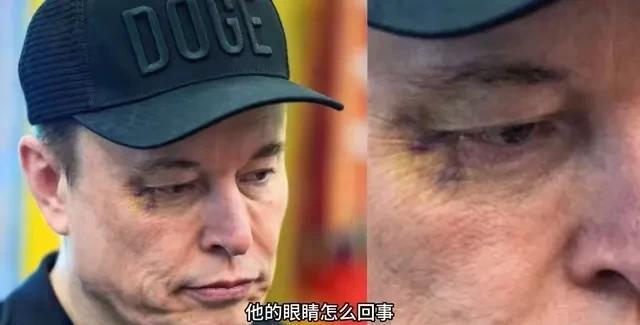 马斯克眼角的这块淤青算是过不去的一个坎儿了。
越来越多的美国媒体在追问他这块淤青