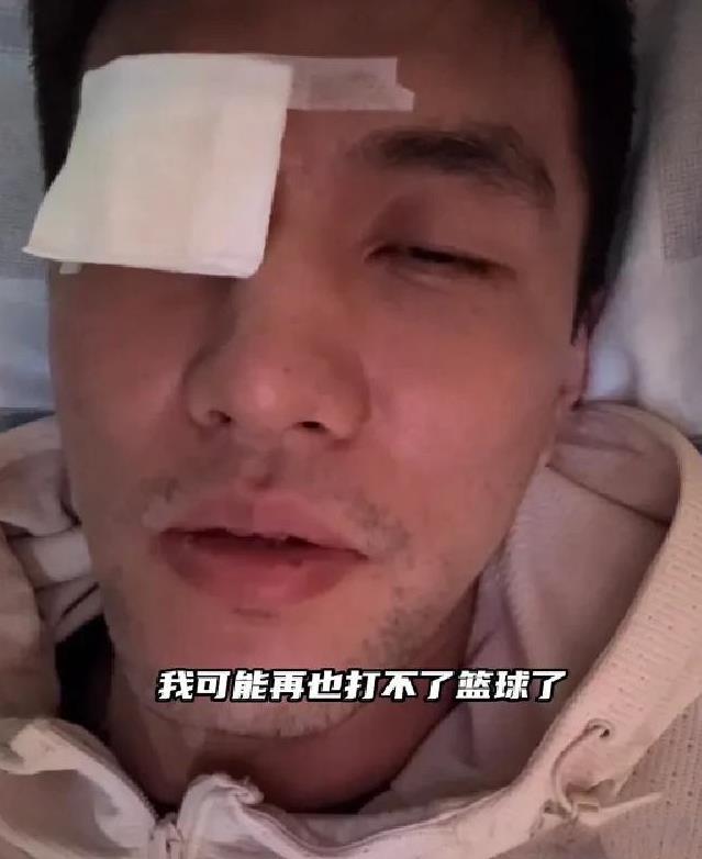 郭艾伦意外受伤，给所有cba球员提个醒：要学习nba佩戴护目镜+牙套，佩戴护具齐