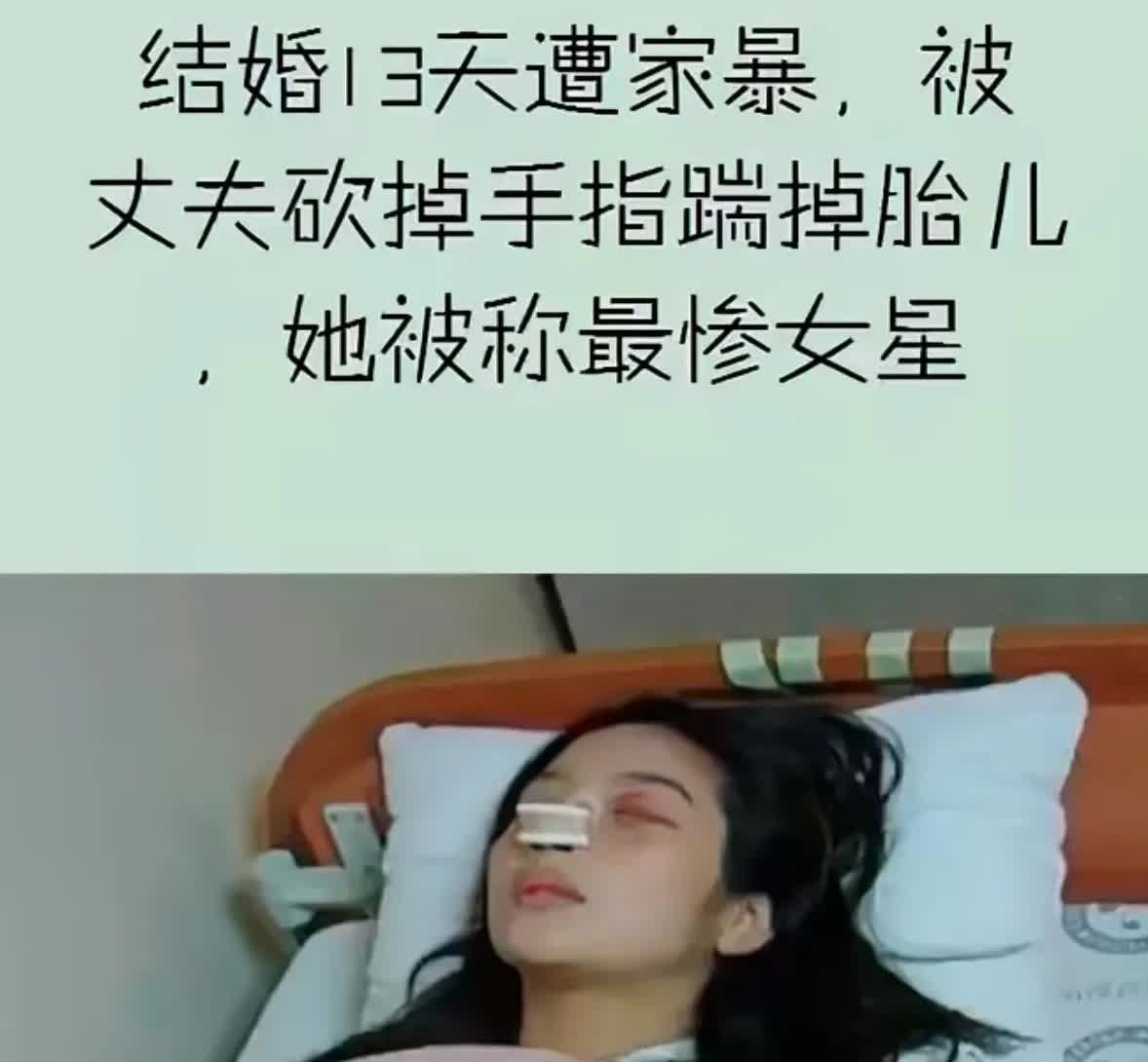 结婚13天被家暴，被丈夫砍掉手指踹掉胎儿，她被称最惨女星