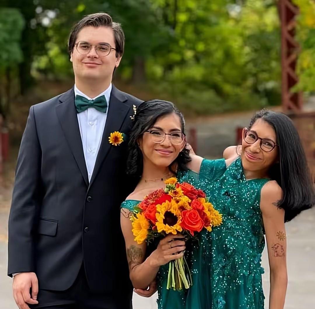 美国一对共用生殖系统的连体姐妹中的妹妹结婚了！
小姐妹俩的脊柱下半部分相连，每人