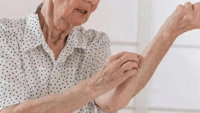 老年人皮肤干燥，瘙痒眼干口干的破局之道