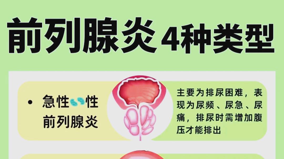 活用少腹逐瘀汤治愈慢性前列腺炎
