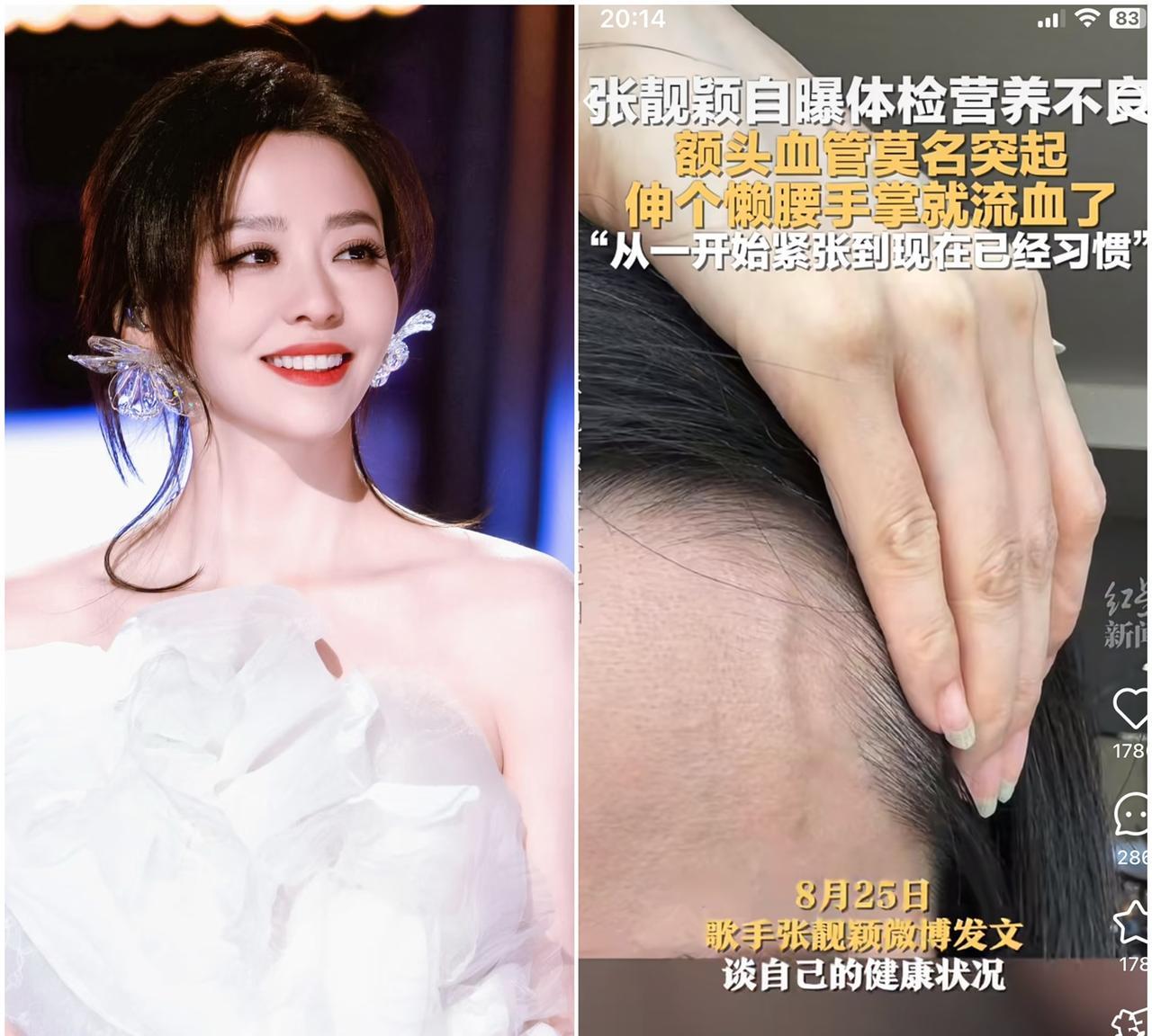 都说明星这么有钱，
怎么会营养不良呢，
其实也不足为奇，现在的女明星为了保持身材