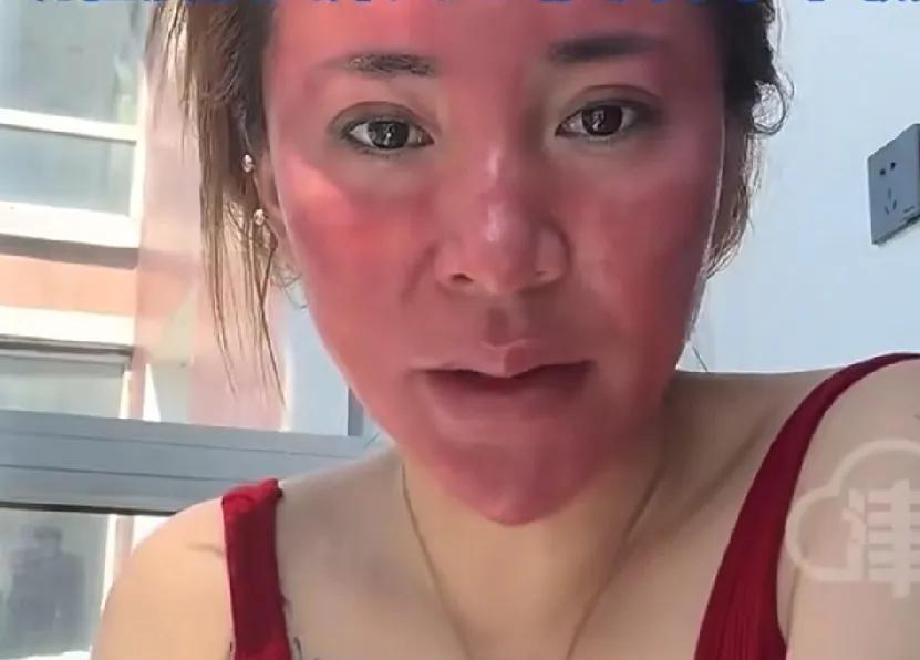 不卸妆22年？！她是怎么做到的？！这位37岁的女子自述不卸妆造成皮肤过敏，成为“