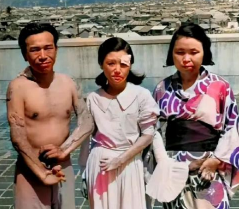 1945年，广岛原子弹爆炸后，三个幸存者，留下了这一张照片，镜头中的他们眼神非常