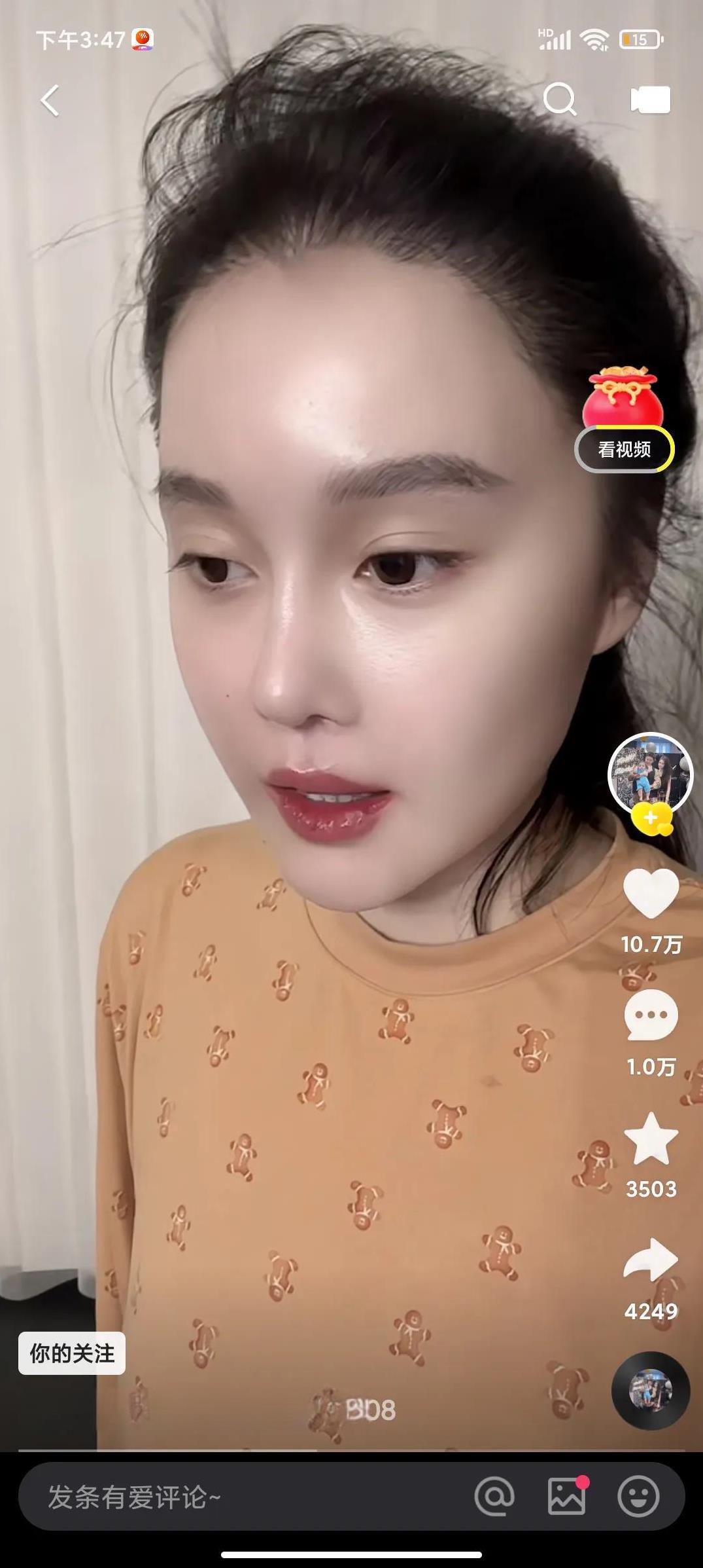 看看这是赵本山的女儿球球，她说她现在得抑郁症了。
感觉她五官虽然标志皮肤白皙不过