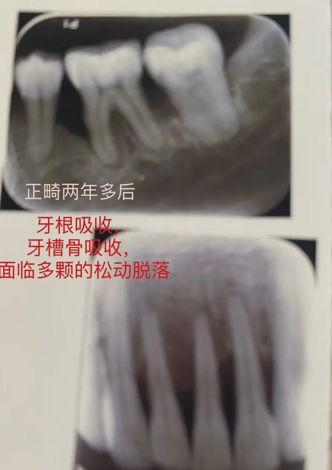 陕西西安，一女子在一家医疗机构花费……真是让人听了都觉得牙疼，这36500元花得