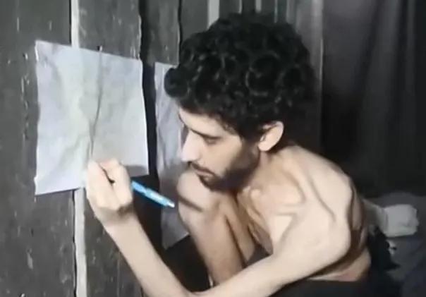 瘦骨伶仃的以色列人质  
       哈马斯公布了以色列人质的照片，以色列人质